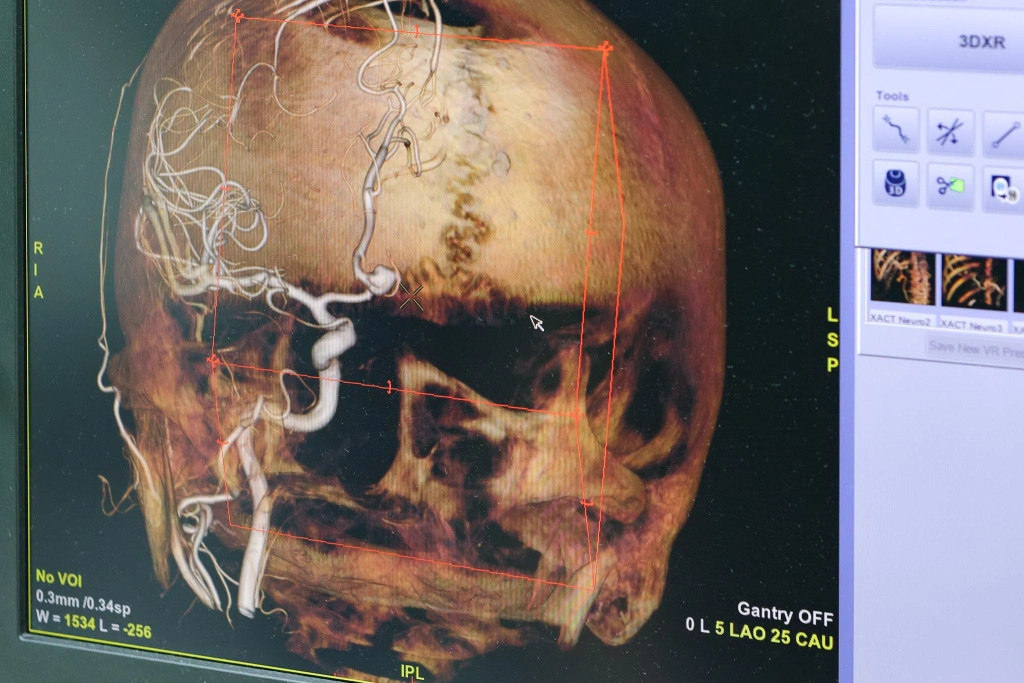 007-Ангиография (16).jpg 007-Ангиография (16).jpg